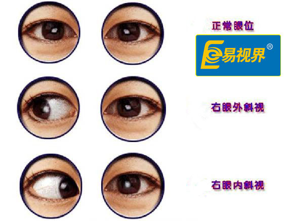 易視界 視疲勞形成的原因