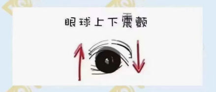 什么是眼球震顫？