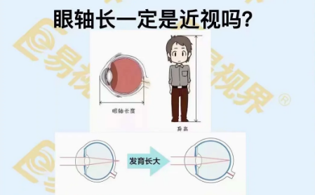 眼軸長一定是近視嗎？