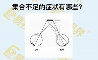 集合不足的癥狀有哪些？